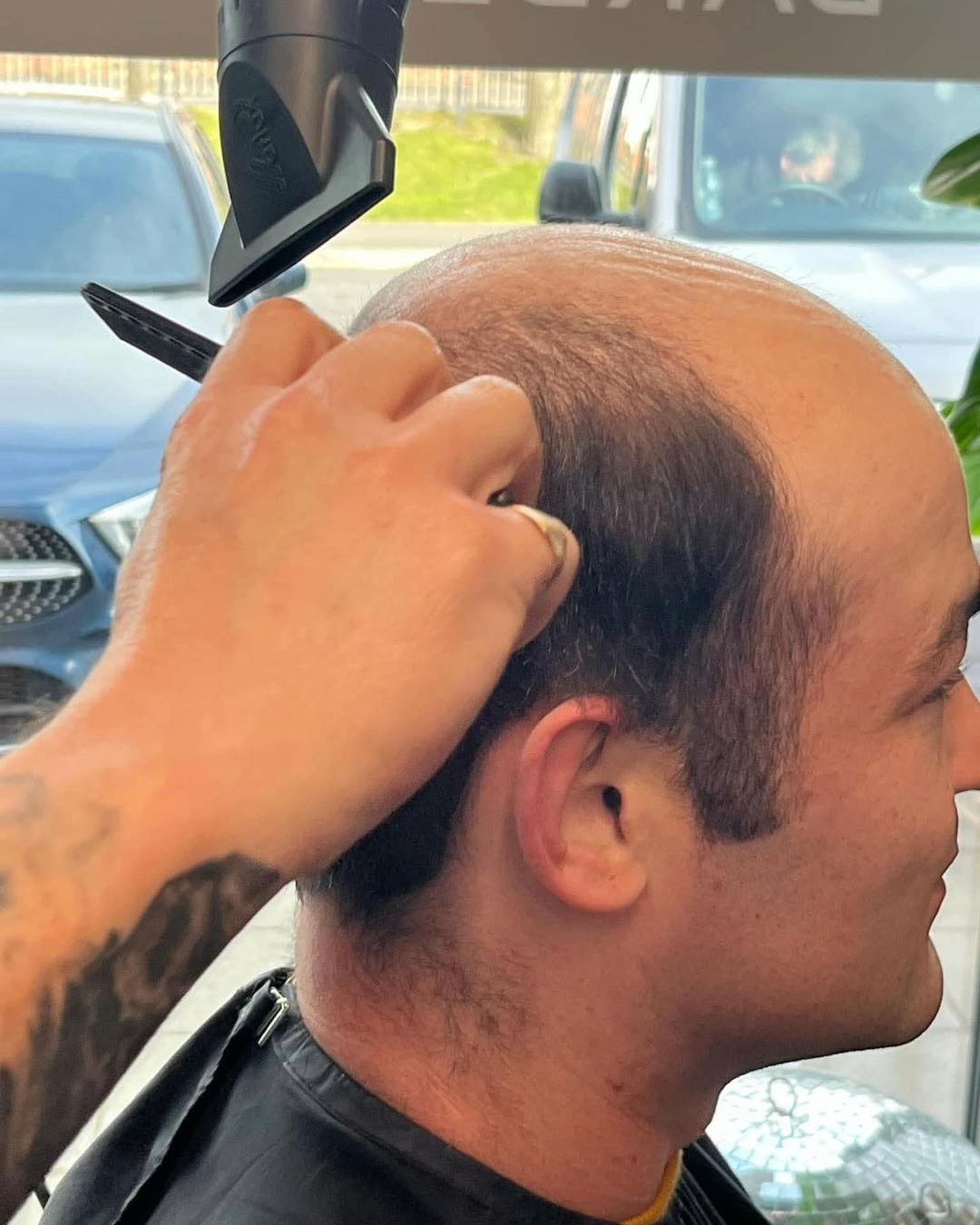Hair Replacement For Men Langley Park Hairdressers Hair Replacement For Men Langley Park Hairdressers
