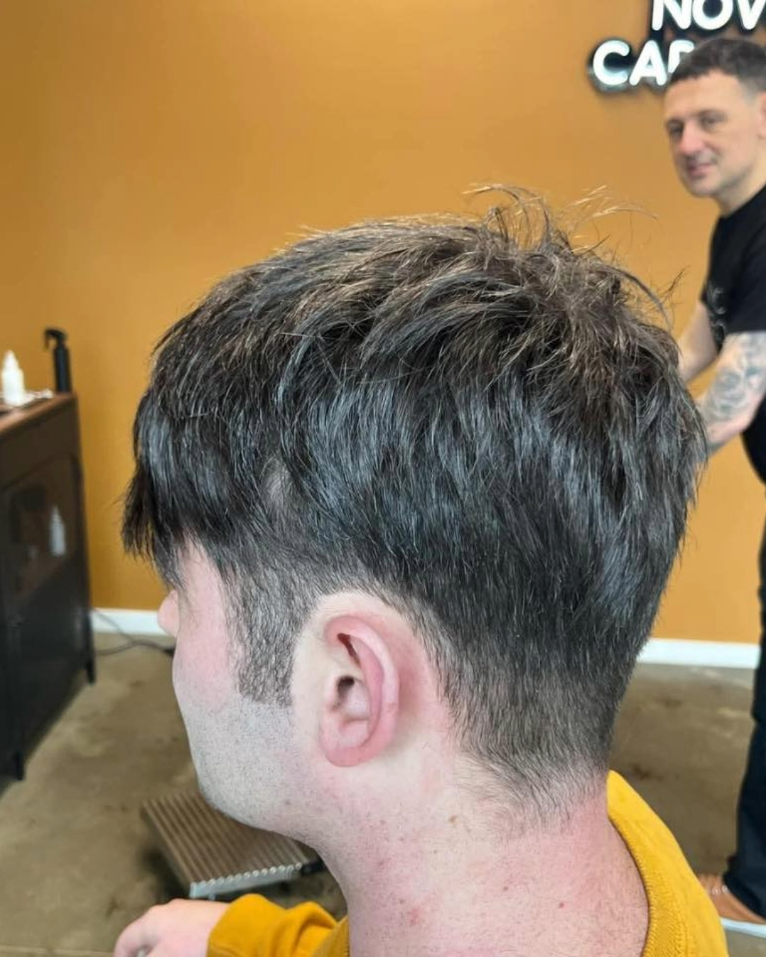 hair loss clinics for women durham hair loss clinics for women durham